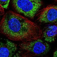 Anti-ABR antibody produced in rabbit 