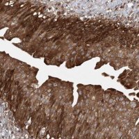 Anti-ACAP2 antibody produced in rabbit 