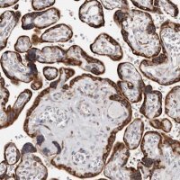 Anti-ACBD6 antibody produced in rabbit 