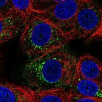 Anti-ACBD7 antibody produced in rabbit 