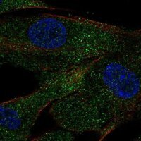 Anti-ACE antibody produced in rabbit 