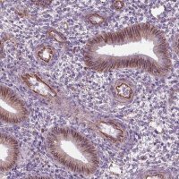 Anti-ACER3 antibody produced in rabbit 