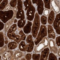 Anti-ACO1 antibody produced in rabbit 