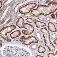 Anti-ACOT1 antibody produced in rabbit 