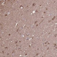 Anti-ACOT6 antibody produced in rabbit 