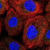 Anti-ACOXL antibody produced in rabbit 