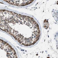 Anti-ACP1 antibody produced in rabbit 