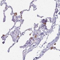 Anti-ACP5 antibody produced in rabbit 