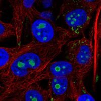 Anti-ACSL3 antibody produced in rabbit 