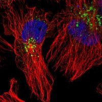 Anti-ACSL4 antibody produced in rabbit 