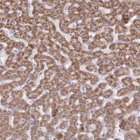 Anti-ACSM2A antibody produced in rabbit 