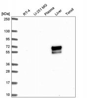 Anti-ACSM2A antibody produced in rabbit 