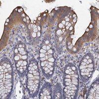 Anti-ACSM3 antibody produced in rabbit 