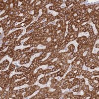 Anti-ACSM4 antibody produced in rabbit 