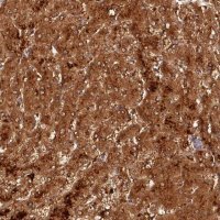 Anti-ACSM5 antibody produced in rabbit 