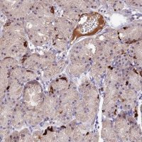Anti-ACSM6 antibody produced in rabbit 