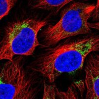 Anti-ACSS3 antibody produced in rabbit 