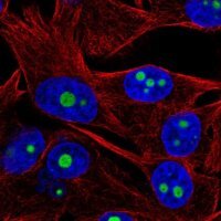 Anti-ACTR10 antibody produced in rabbit 