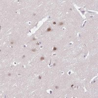 Anti-ACTR3 antibody produced in rabbit 