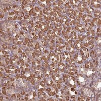 Anti-ACTR3 antibody produced in rabbit HPA051683-100UL