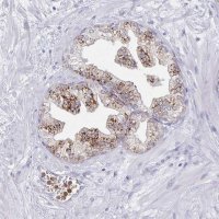 Anti-ACTR3C antibody produced in rabbit 