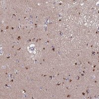 Anti-ACTR5 antibody produced in rabbit 