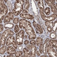 Anti-ACTR6 antibody produced in rabbit 