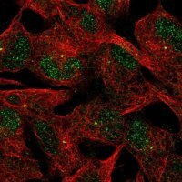 Anti-ACTR8 antibody produced in rabbit 