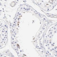 Anti-ACTRT1 antibody produced in rabbit 