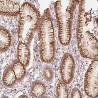 Anti-ACVR1B antibody produced in rabbit HPA063761-100UL