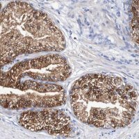 Anti-ACVR1C antibody produced in rabbit 