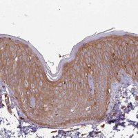 Anti-ACVR2A antibody produced in rabbit