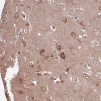 Anti-ACVR2A antibody produced in rabbit