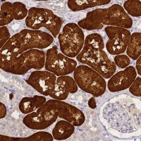 Anti-ACY1 antibody produced in rabbit 