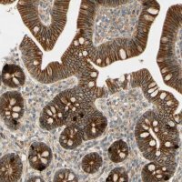 Anti-ADAM17 antibody produced in rabbit 