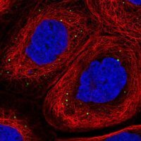 Anti-ADAM19 antibody produced in rabbit 