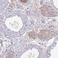 Anti-ADAM21 antibody produced in rabbit 