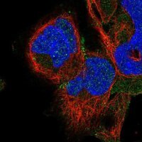 Anti-ADAM22 antibody produced in rabbit 