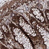 Anti-ADAM23 antibody produced in rabbit 