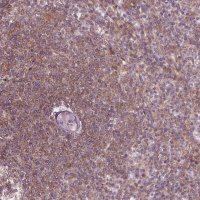 Anti-ADAM33 antibody produced in rabbit 