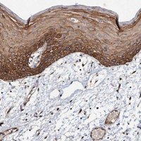 Anti-ADAMTS10 antibody produced in rabbit 