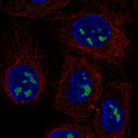 Anti-ADAMTS12 antibody produced in rabbit 