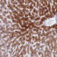 Anti-ADAMTS13 antibody produced in rabbit 