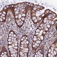 Anti-ADAMTS15 antibody produced in rabbit 