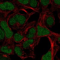 Anti-ADAMTS17 antibody produced in rabbit 