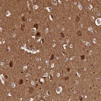 Anti-ADAMTS18 antibody produced in rabbit 