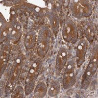 Anti-ADAMTS20 antibody produced in rabbit 
