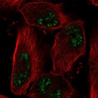 Anti-ADAMTS4 antibody produced in rabbit 