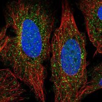 Anti-ADAMTS7 antibody produced in rabbit 