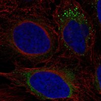 Anti-ADAMTS9 antibody produced in rabbit 